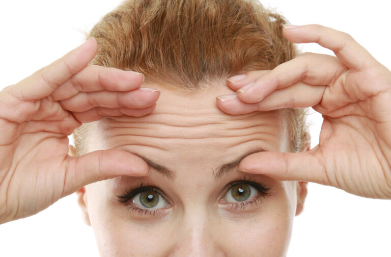 Arrugas en la frente